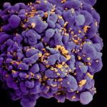HIV